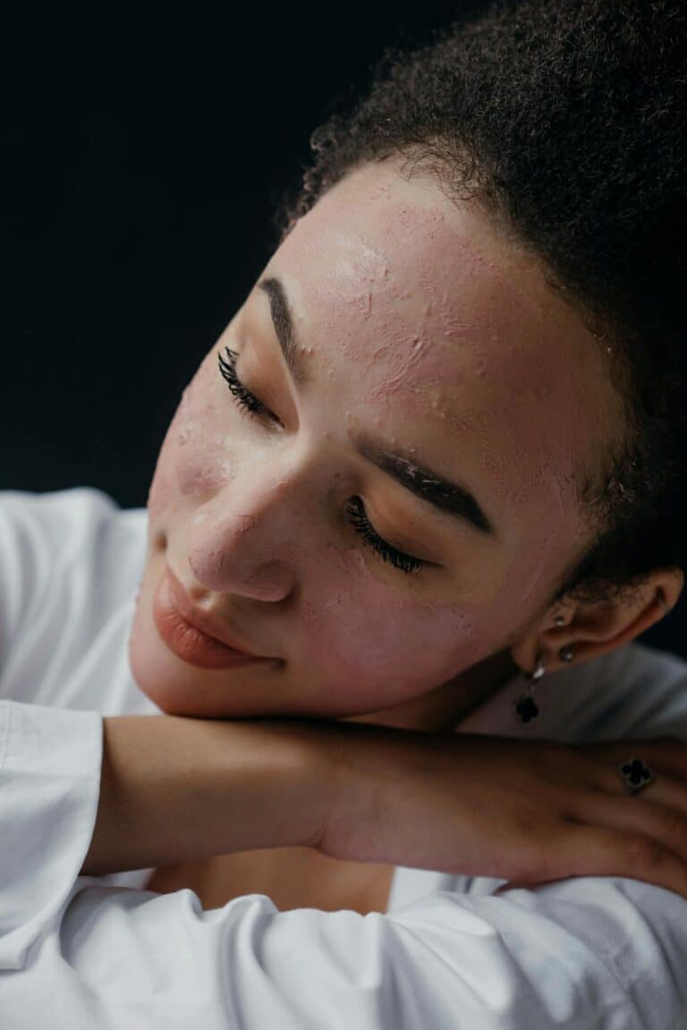 Karsprængninger i ansigtet